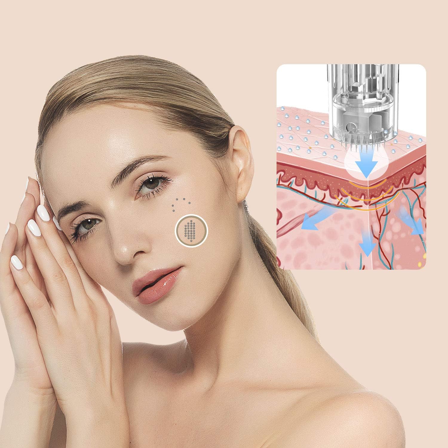 Agujas estériles para microneedling