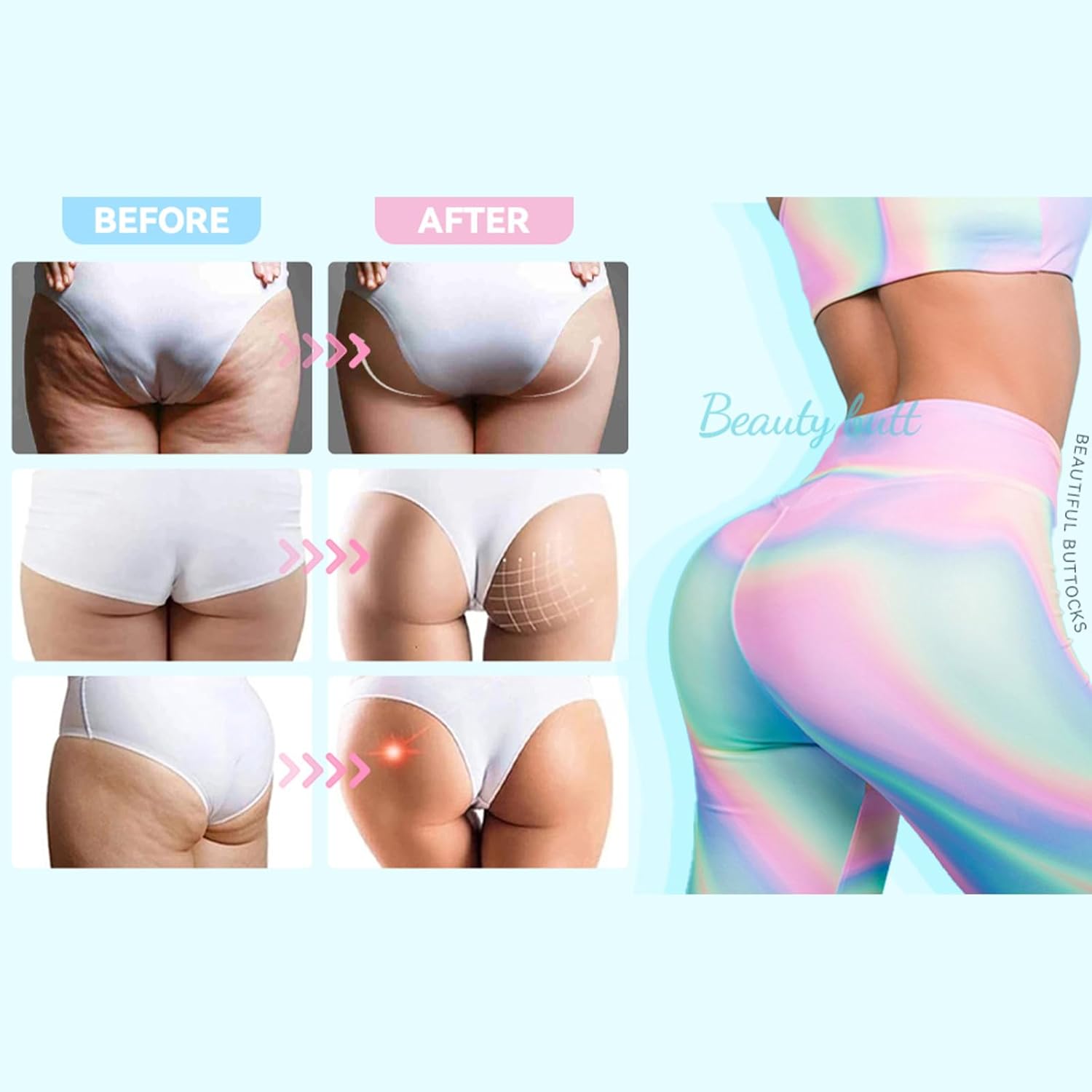 Ventosas de Vacío Yofuly XL